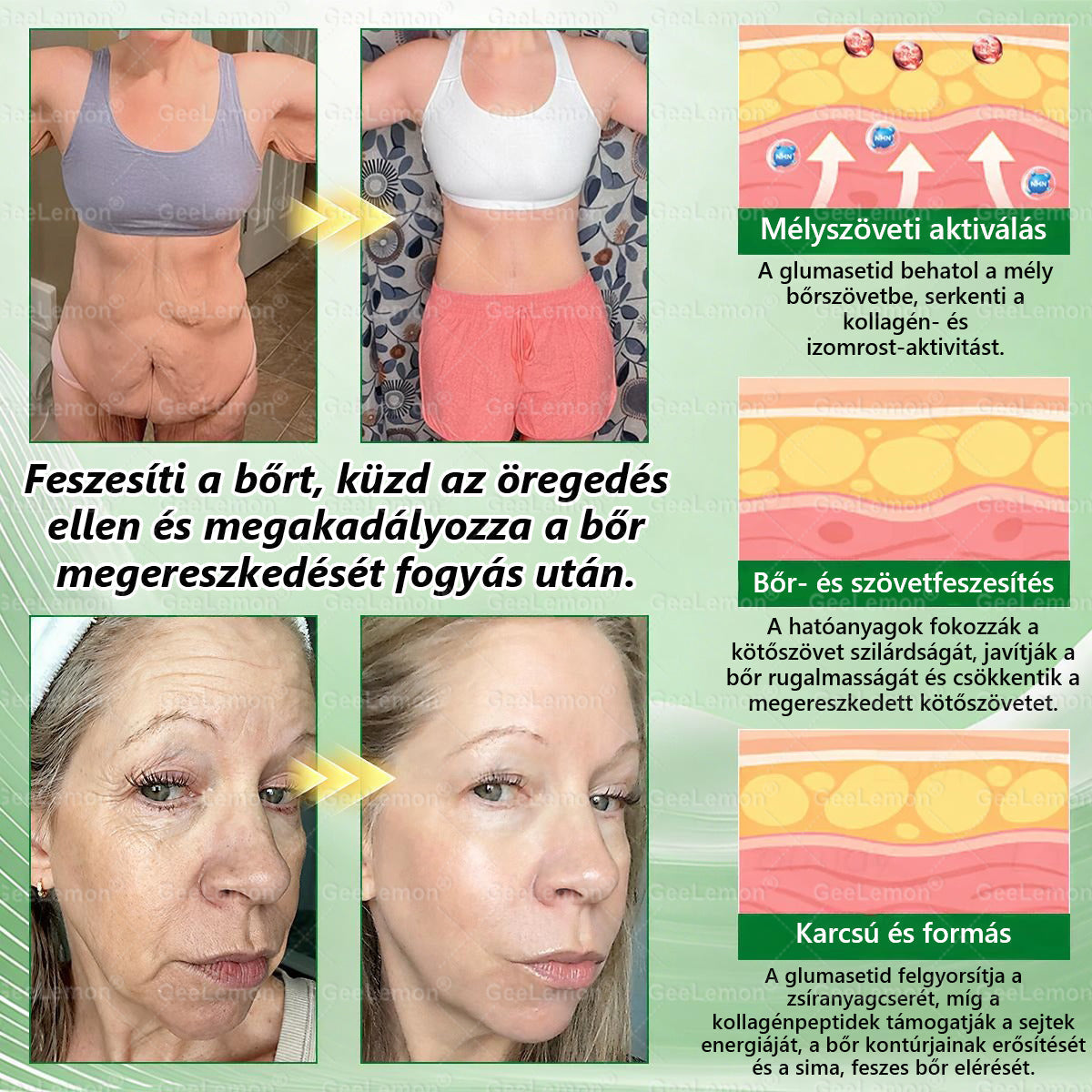 Ajánlott a Semmelweis Kórház által · 👩‍⚕️BENU hivatalos üzlet| 🎁 𝐆𝐞𝑒𝐿𝑒𝐦𝐨𝐧® Glumasetide 8 az 1-ben Karcsú és Egészséges Nano Mikrotűs Tapasz