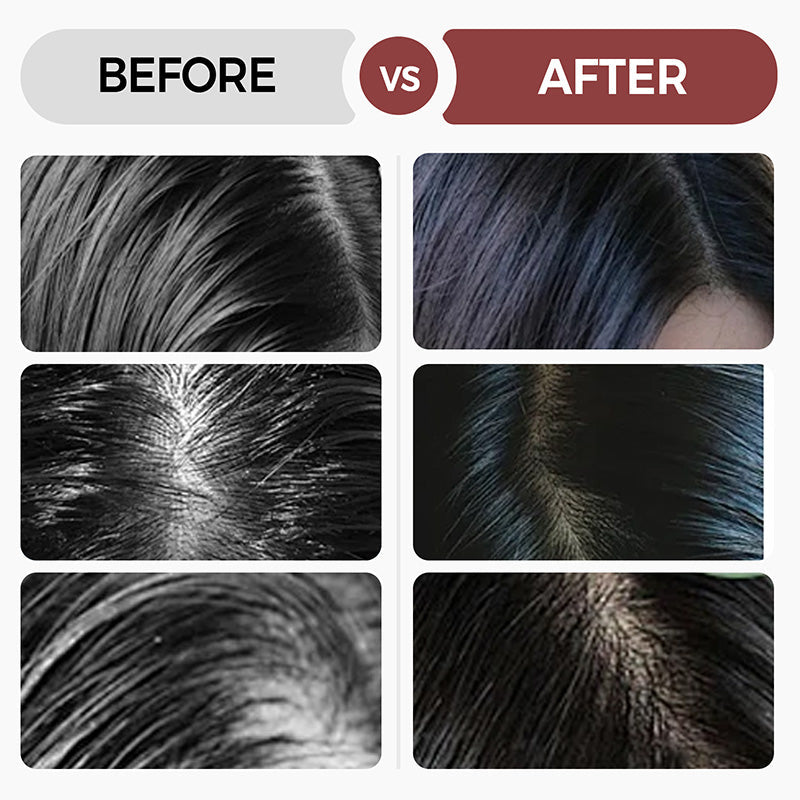 💥Most világszerte akciósan🔥Újonnan kifejlesztett mélyhidratáló hajpakolás⏲️Korlátozott ideig érvényes ajánlat, vásárolj többet, többet kapsz ingyen